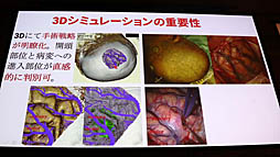 画像ギャラリー No.002のサムネイル画像 / ［Unite 2019］VR/ARによる最先端医療が紹介されたセッション「手術革命がUnityから始まっている〜VR活用事例と開発」聴講レポート