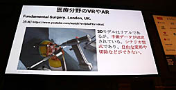 画像ギャラリー No.007のサムネイル画像 / ［Unite 2019］VR/ARによる最先端医療が紹介されたセッション「手術革命がUnityから始まっている〜VR活用事例と開発」聴講レポート