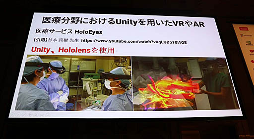 画像ギャラリー No.008のサムネイル画像 / ［Unite 2019］VR/ARによる最先端医療が紹介されたセッション「手術革命がUnityから始まっている〜VR活用事例と開発」聴講レポート