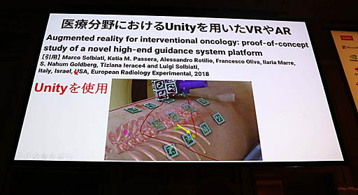 画像ギャラリー No.009のサムネイル画像 / ［Unite 2019］VR/ARによる最先端医療が紹介されたセッション「手術革命がUnityから始まっている〜VR活用事例と開発」聴講レポート