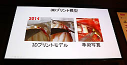 画像ギャラリー No.014のサムネイル画像 / ［Unite 2019］VR/ARによる最先端医療が紹介されたセッション「手術革命がUnityから始まっている〜VR活用事例と開発」聴講レポート