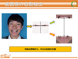 画像ギャラリー No.019のサムネイル画像 / ［CEDEC 2013］早稲田大学が発表した次世代のグラフィックス表現は「埃」と「口内」に注目？