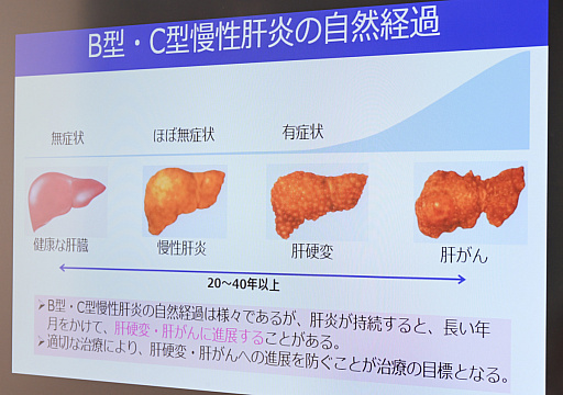 画像ギャラリー No.005のサムネイル画像 / 肝炎は“ならないことを知る時代”に。人生系ボードゲーム「肝炎すごろく」を生み出した医療前線のトップランナーたち